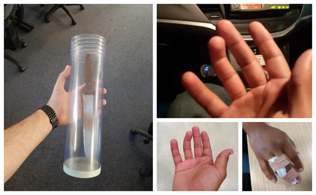 Fleeing Peterborough criminal breaks police officer’s finger