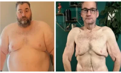 Before and after for Wayne Shepherd: “I know I got myself in to this mess by putting the weight on in the first place but it’s not that simple at all. there was so many more factors than just over eating.”