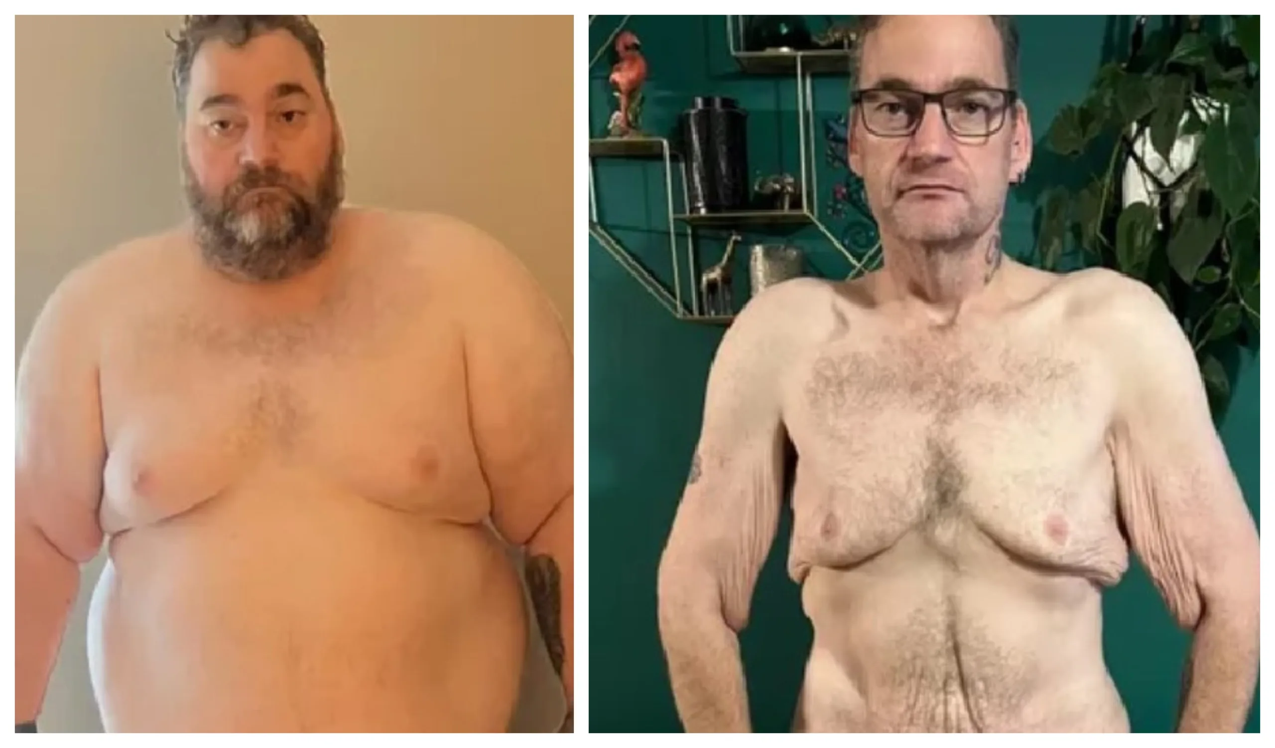 Before and after for Wayne Shepherd: “I know I got myself in to this mess by putting the weight on in the first place but it’s not that simple at all. there was so many more factors than just over eating.”