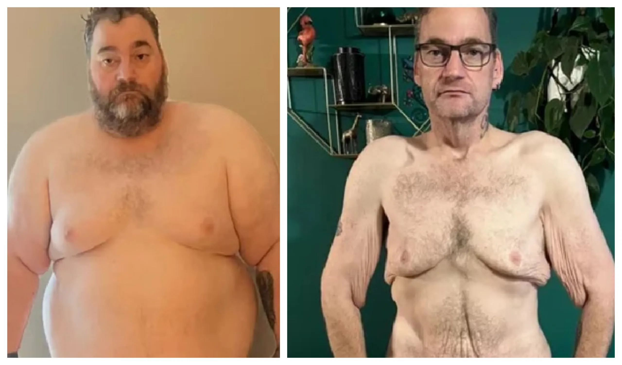 Before and after for Wayne Shepherd: “I know I got myself in to this mess by putting the weight on in the first place but it’s not that simple at all. there was so many more factors than just over eating.” Before and after for Wayne Shepherd: “I know I got myself in to this mess by putting the weight on in the first place but it’s not that simple at all. there was so many more factors than just over eating.”