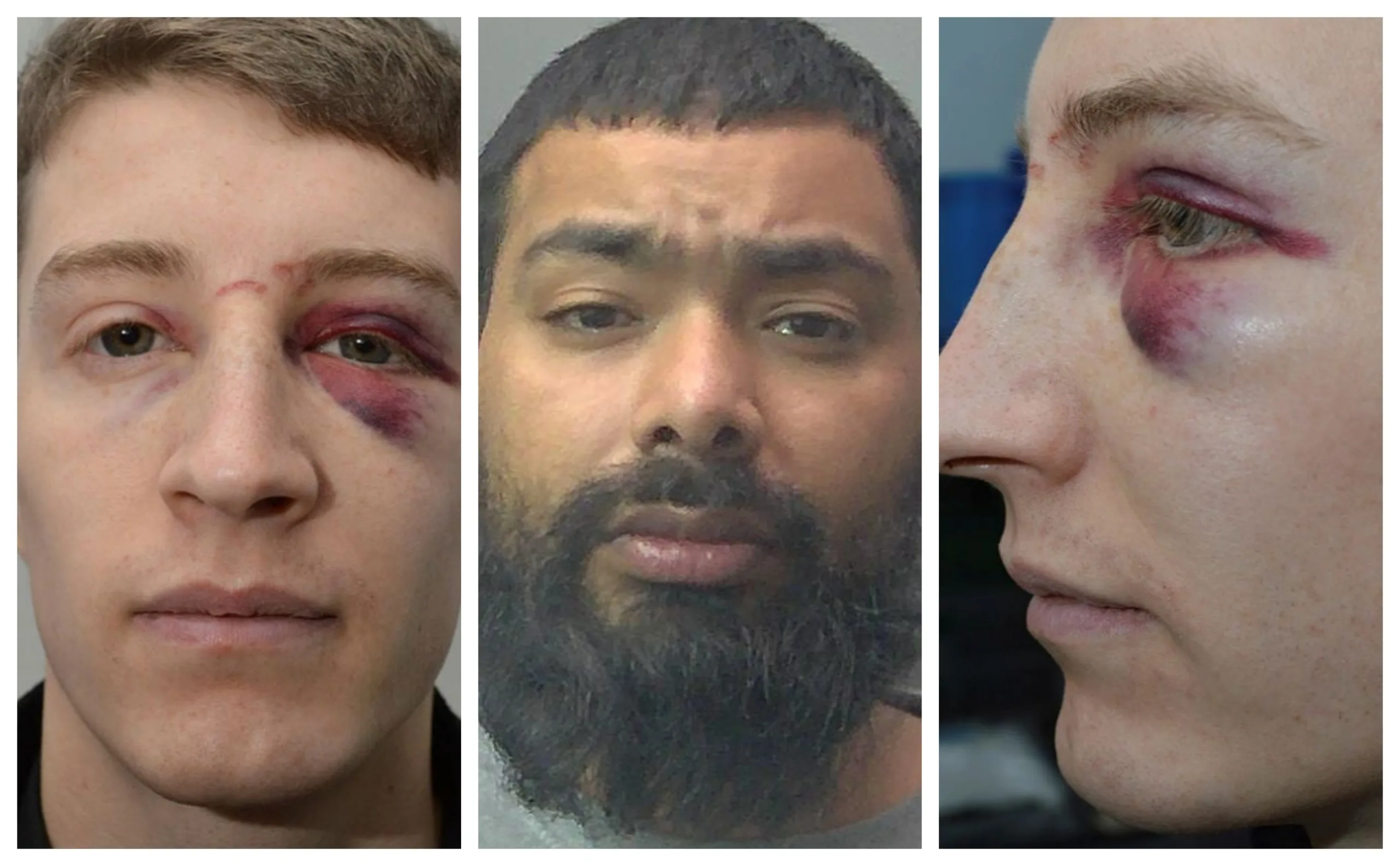 PC Sam Darling, left with broken nose and eye socket after Nadir Bugtti (centre) attacked him, says incident ‘made me second think the job as I know it’